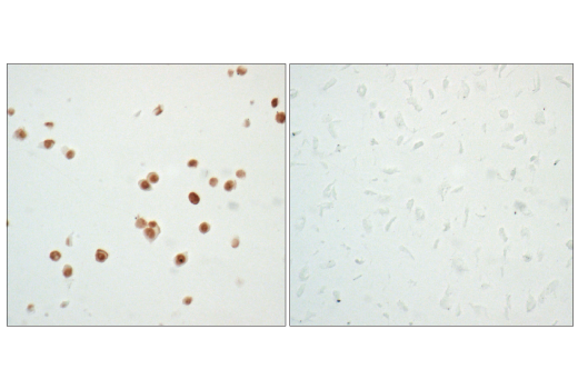 Immunohistochemistry Image 3: p53 (7F5) Rabbit mAb (BSA and Azide Free)