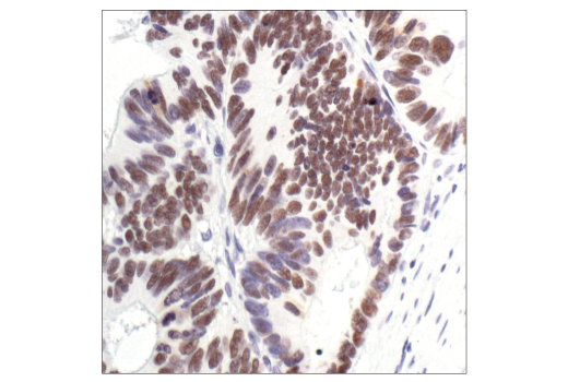 Immunohistochemistry Image 2: p53 (7F5) Rabbit mAb (BSA and Azide Free)