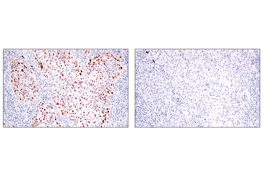 Immunohistochemistry Image 6: p14 ARF (E3X6D) Rabbit mAb