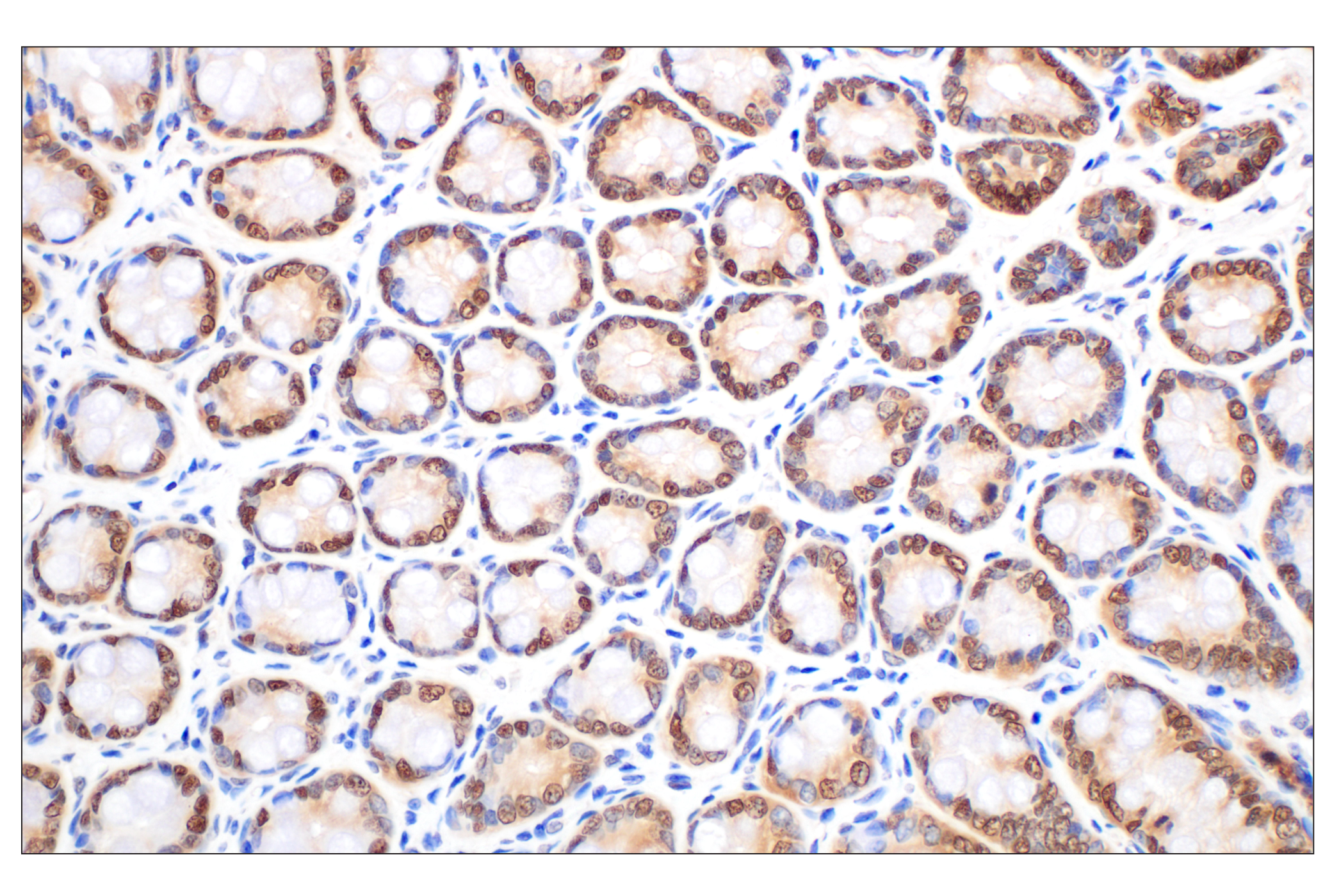 Immunohistochemistry Image 10: MTAP (E5R1I) Rabbit mAb