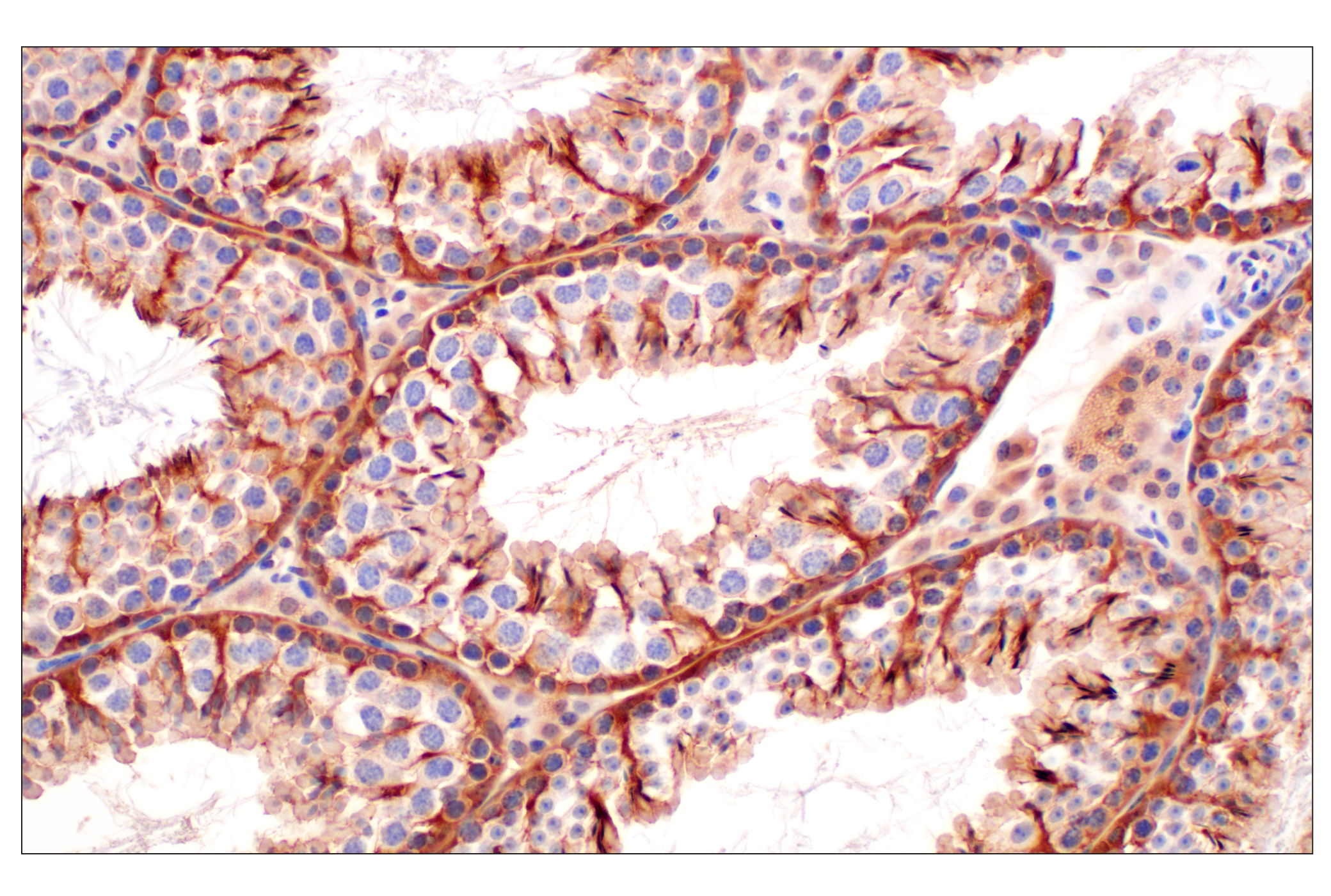 Immunohistochemistry Image 9: MTAP (E5R1I) Rabbit mAb