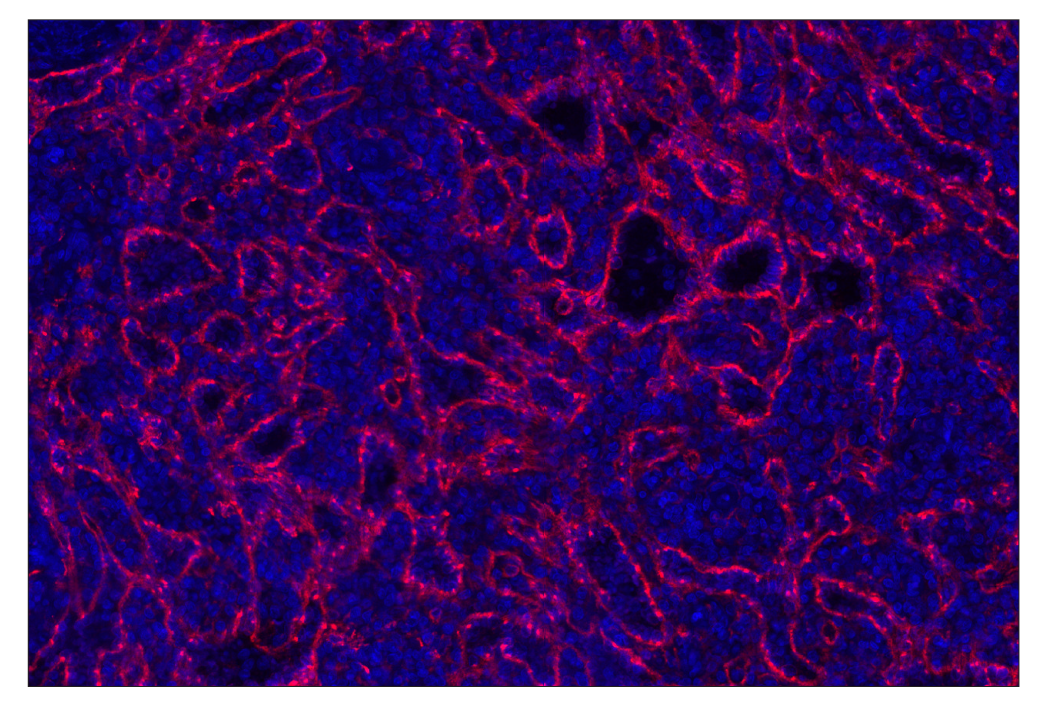 Immunohistochemistry Image 2: CD206/MRC1 (E2L9N) Rabbit mAb (Alexa Fluor® 647 Conjugate)