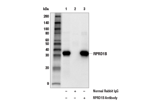 Immunoprecipitation Image 1: RPRD1B Antibody