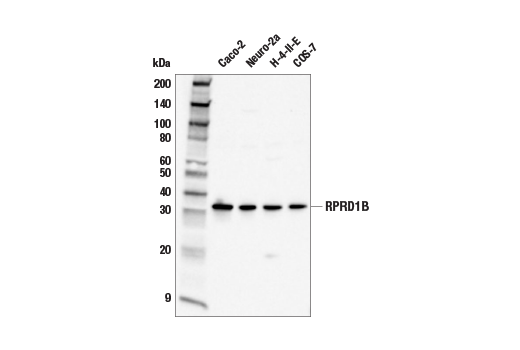 Western Blotting Image 1: RPRD1B Antibody