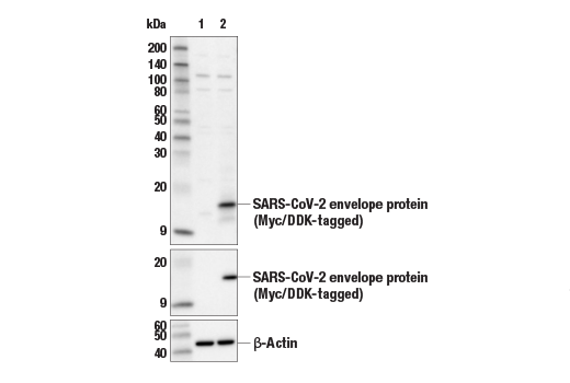 Western Blotting Image 1: SARS-CoV-2 Envelope Protein Antibody