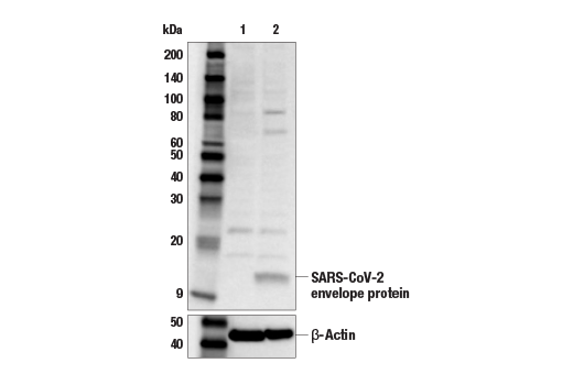 Western Blotting Image 2: SARS-CoV-2 Envelope Protein Antibody