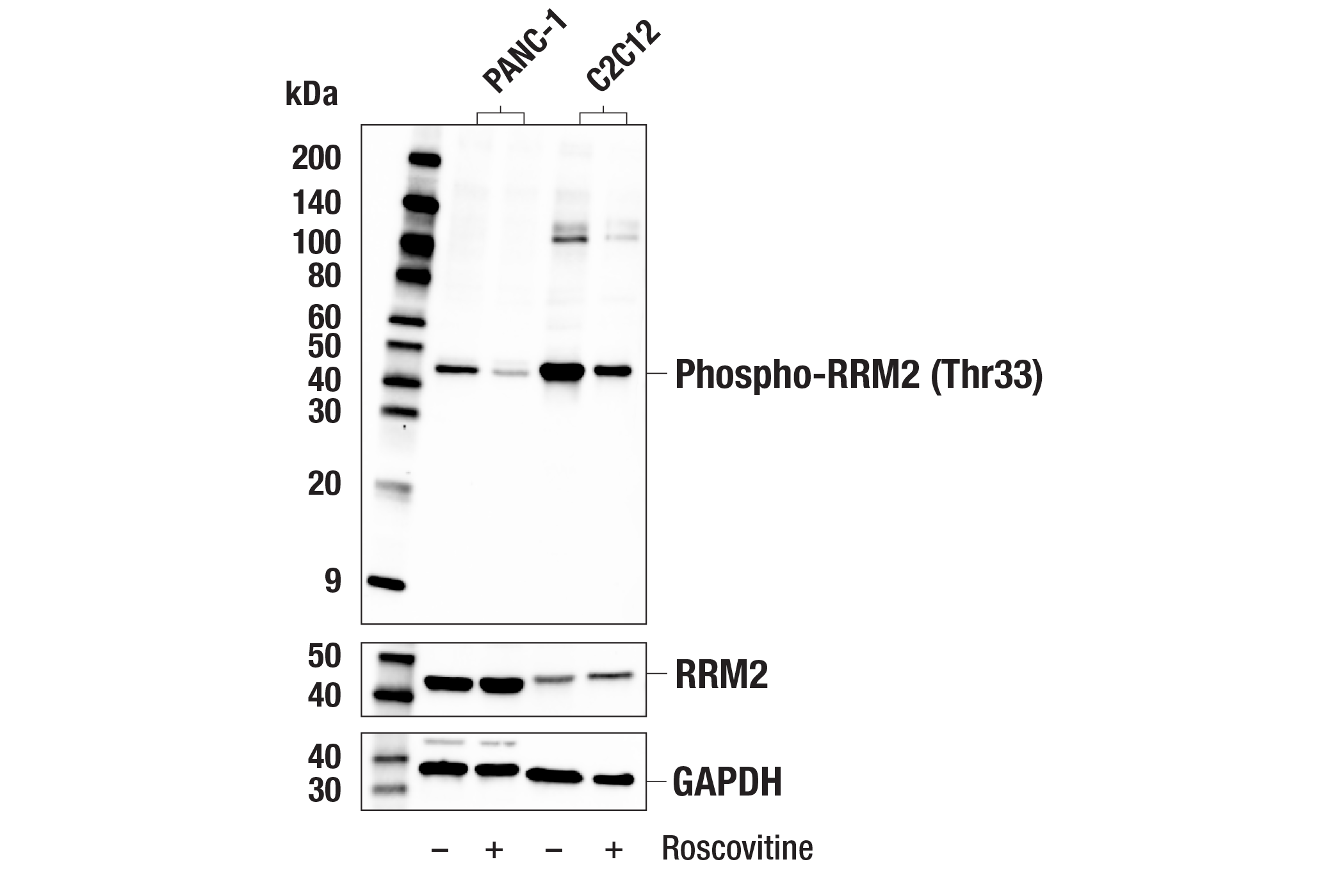 Western Blotting Image 1: Phospho-RRM2 (Thr33) Antibody
