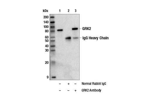 Immunoprecipitation Image 1: GRK2 Antibody