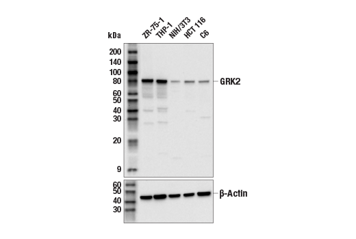 Western Blotting Image 1: GRK2 Antibody