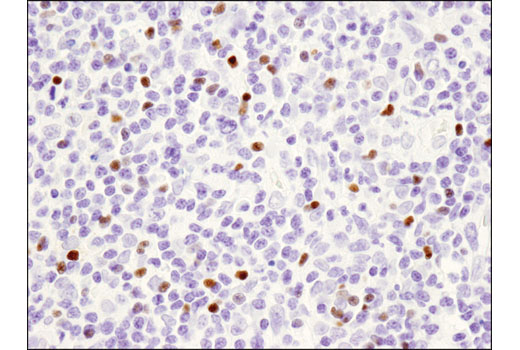 Immunohistochemistry Image 2: FoxP3 (D2W8E™) Rabbit mAb (BSA and Azide Free)