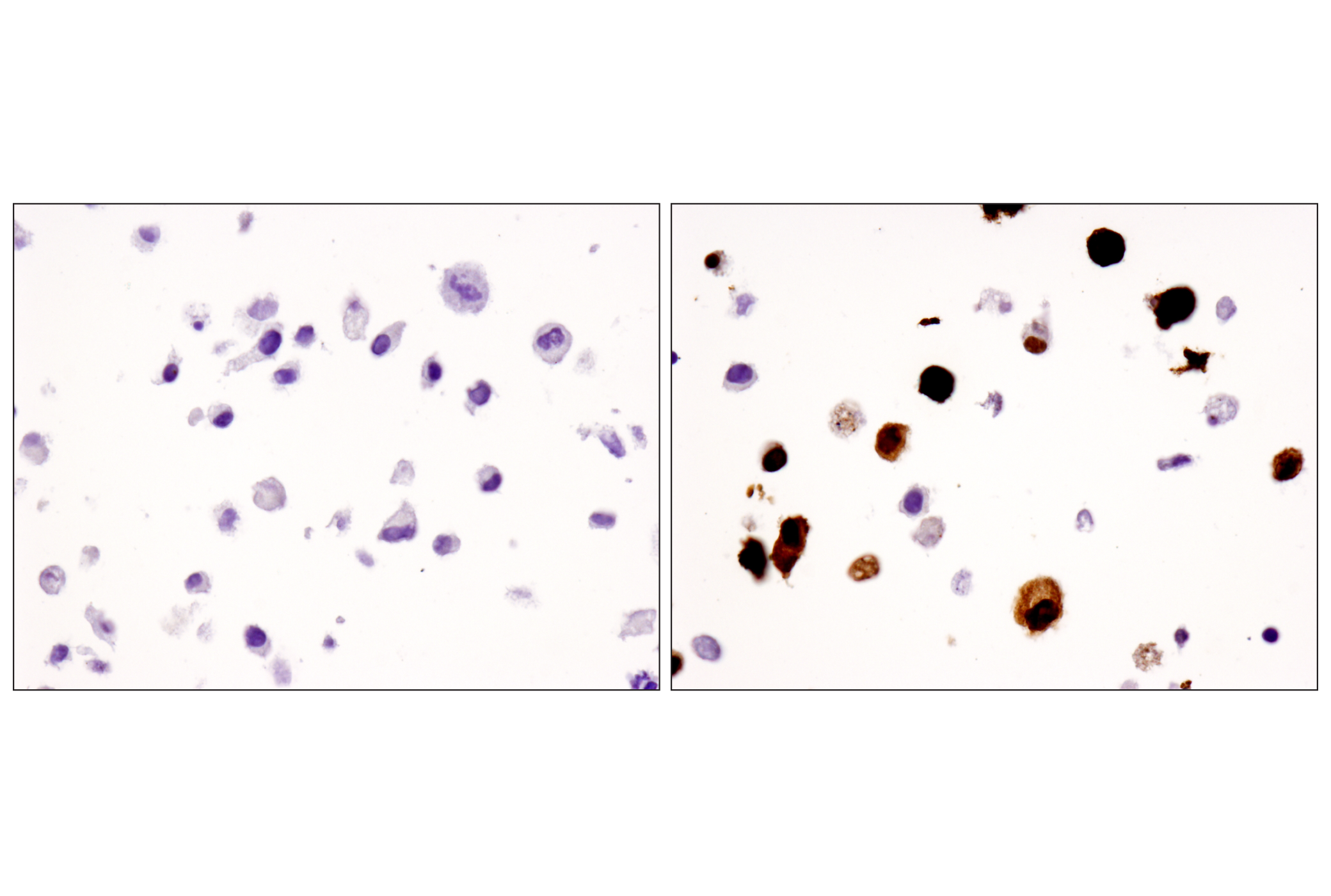 Immunohistochemistry Image 5: FoxP3 (D2W8E™) Rabbit mAb (BSA and Azide Free)