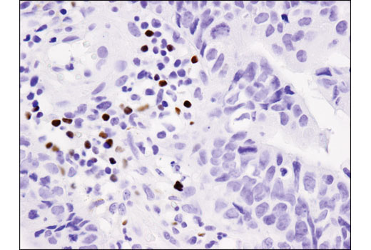 Immunohistochemistry Image 3: FoxP3 (D2W8E™) Rabbit mAb (BSA and Azide Free)