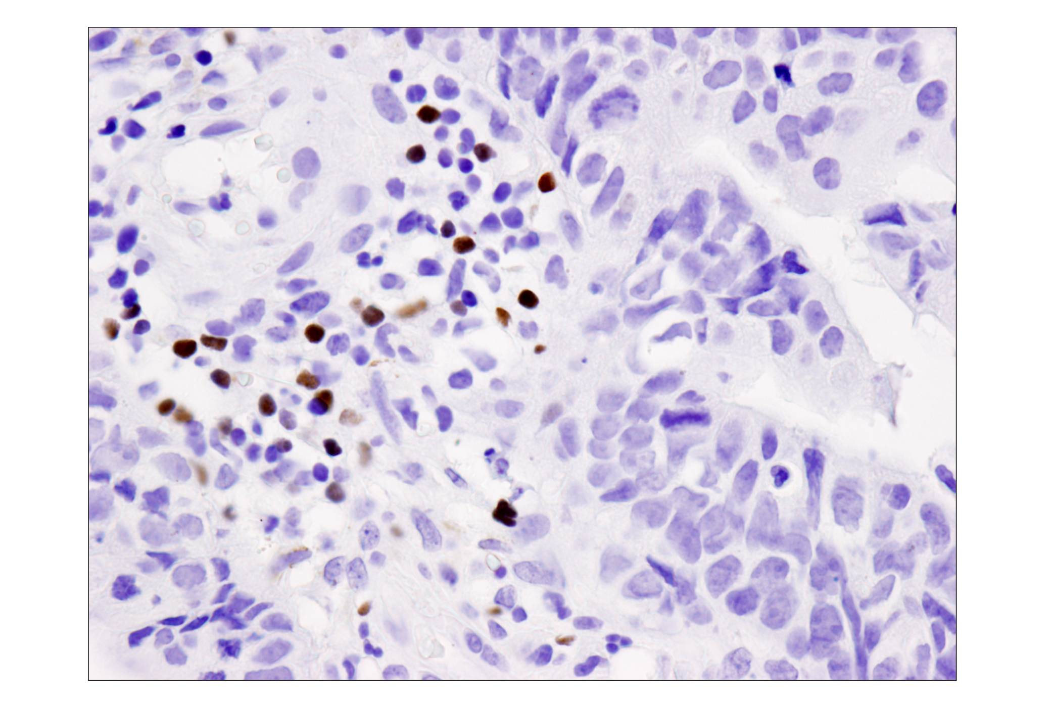 Immunohistochemistry Image 2: FoxP3 (D2W8E™) Rabbit mAb (BSA and Azide Free)