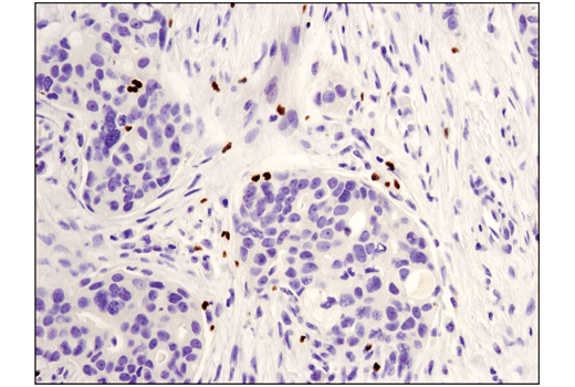 Immunohistochemistry Image 1: FoxP3 (D2W8E™) Rabbit mAb (BSA and Azide Free)