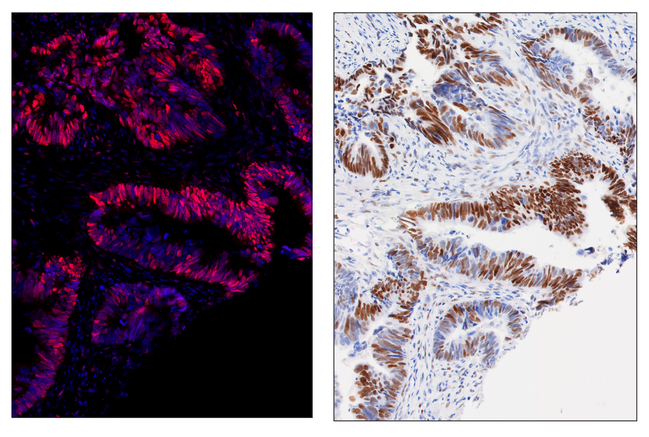 Immunohistochemistry Image 6: c-Fos (E2I7R) & CO-0131-594 SignalStar™ Oligo-Antibody Pair