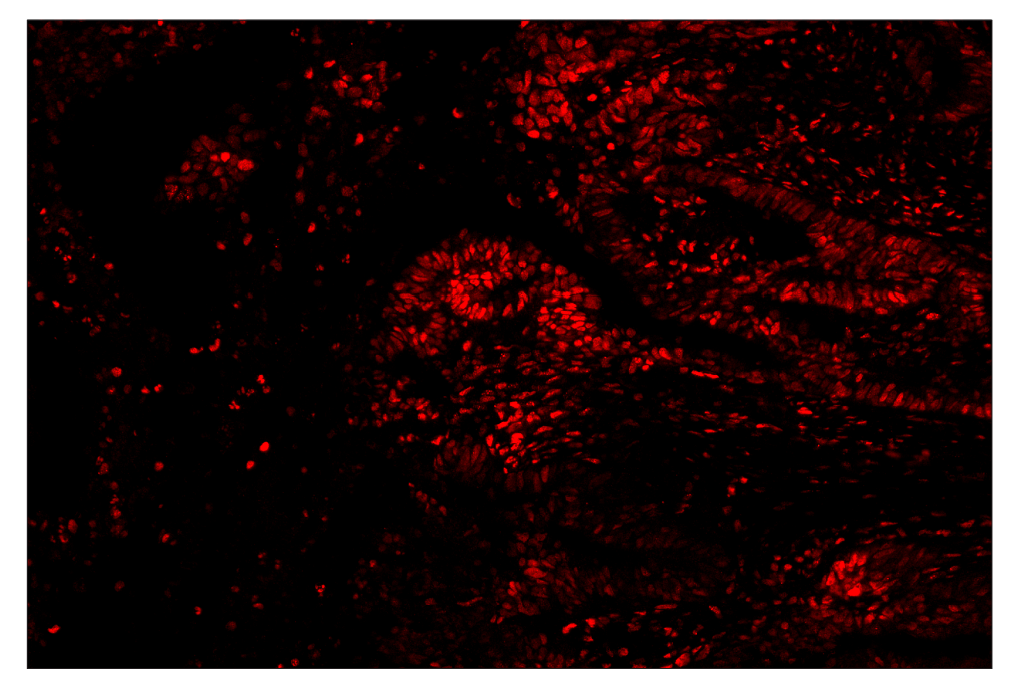 Immunohistochemistry Image 4: c-Fos (E2I7R) & CO-0131-594 SignalStar™ Oligo-Antibody Pair