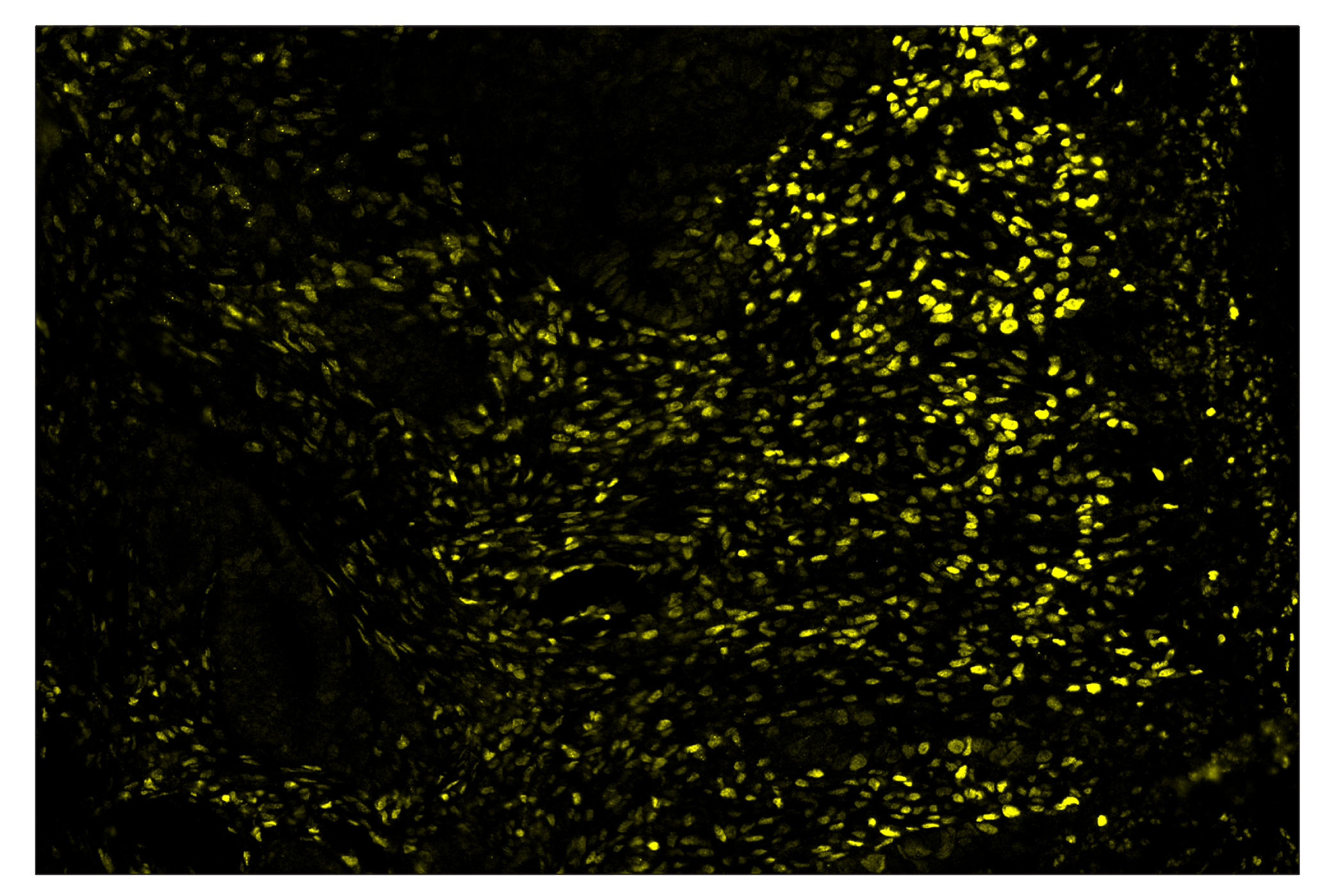 Immunohistochemistry Image 3: c-Fos (E2I7R) & CO-0131-594 SignalStar™ Oligo-Antibody Pair