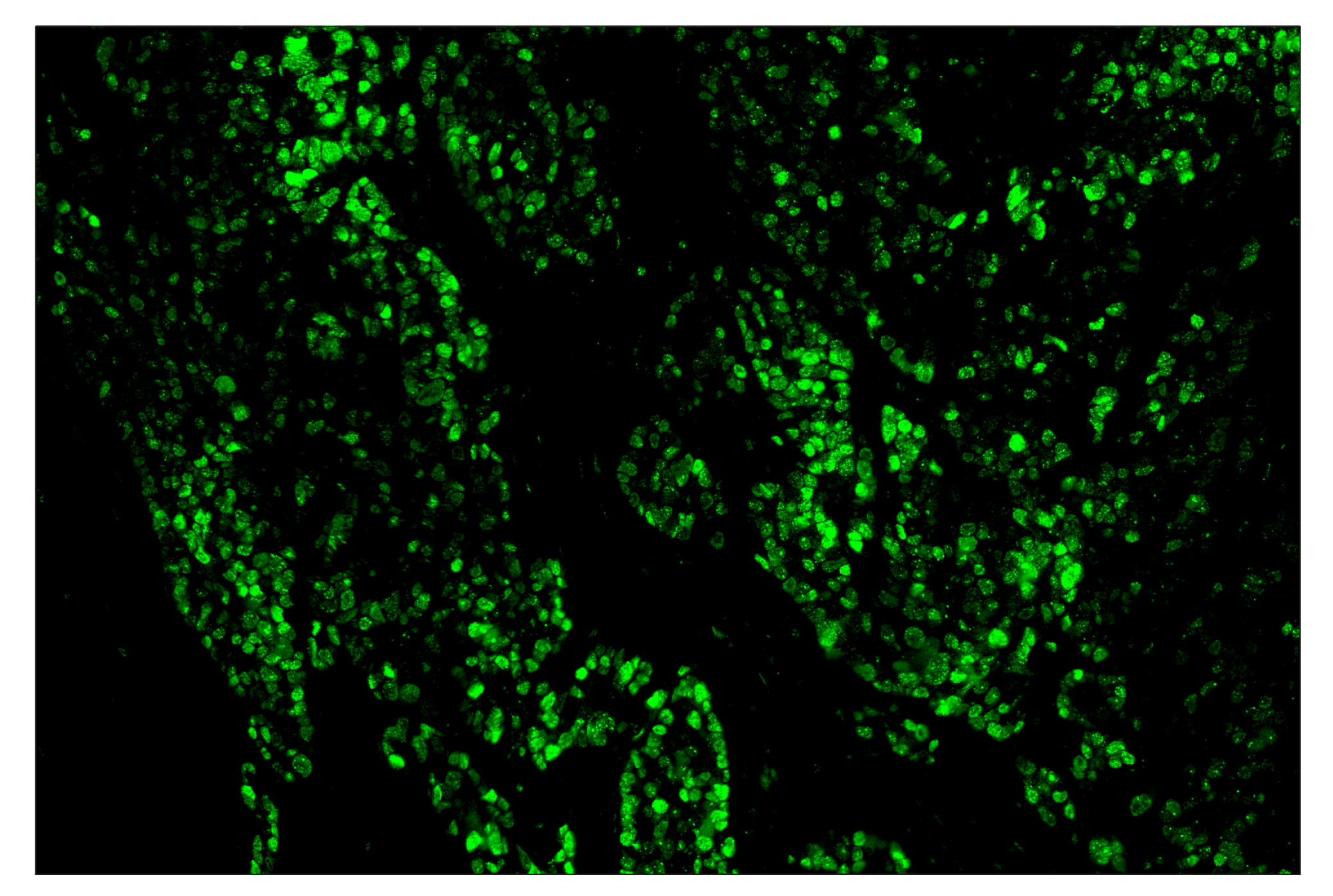 Immunohistochemistry Image 2: c-Fos (E2I7R) & CO-0131-594 SignalStar™ Oligo-Antibody Pair