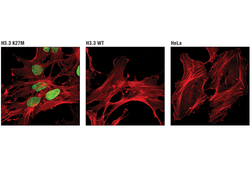 Immunofluorescence Image 1: Histone H3 (K27M Mutant Specific) (D3B5T) Rabbit mAb