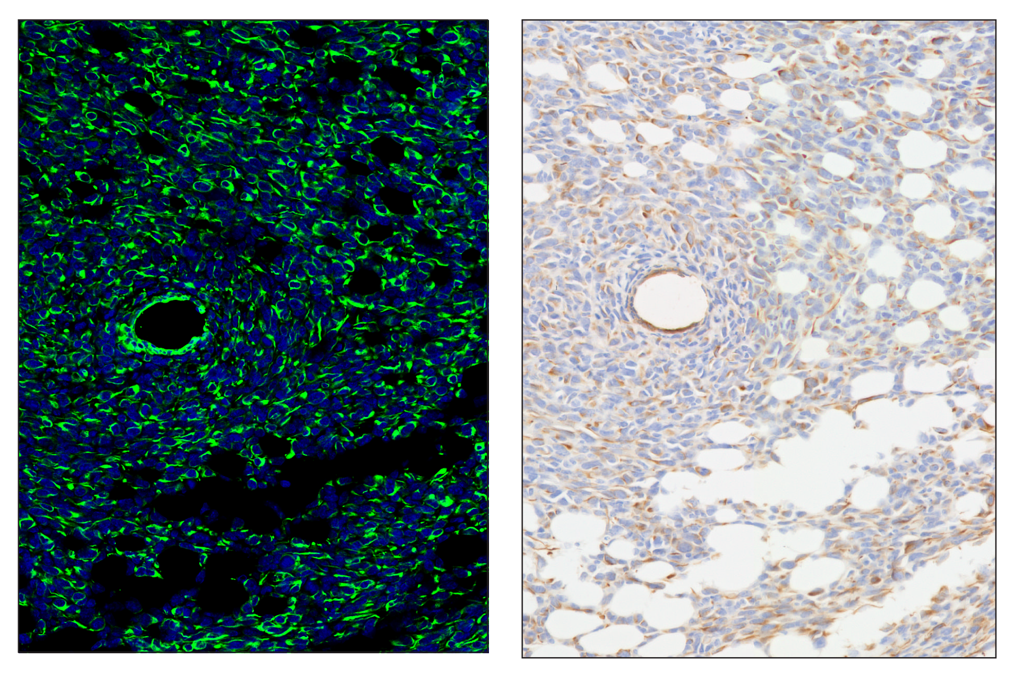 Immunohistochemistry Image 6: Pan-Keratin (Type I) (E6S1S) & CO-0072-594 SignalStar™ Oligo-Antibody Pair