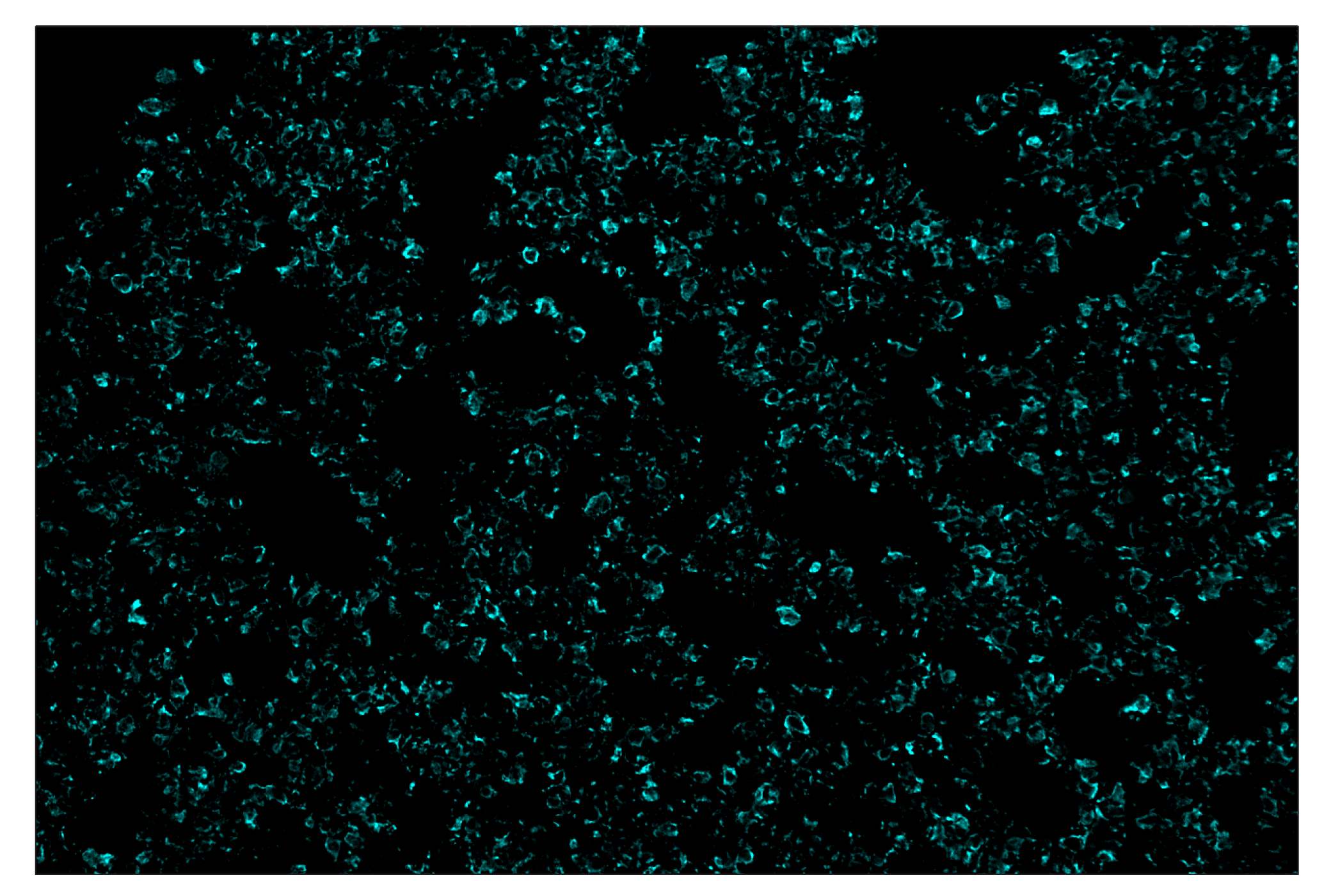 Immunohistochemistry Image 5: Pan-Keratin (Type I) (E6S1S) & CO-0072-750 SignalStar™ Oligo-Antibody Pair