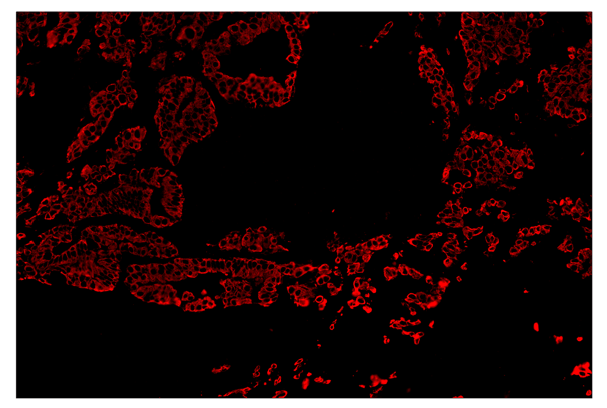 Immunohistochemistry Image 4: Pan-Keratin (Type I) (E6S1S) & CO-0072-750 SignalStar™ Oligo-Antibody Pair