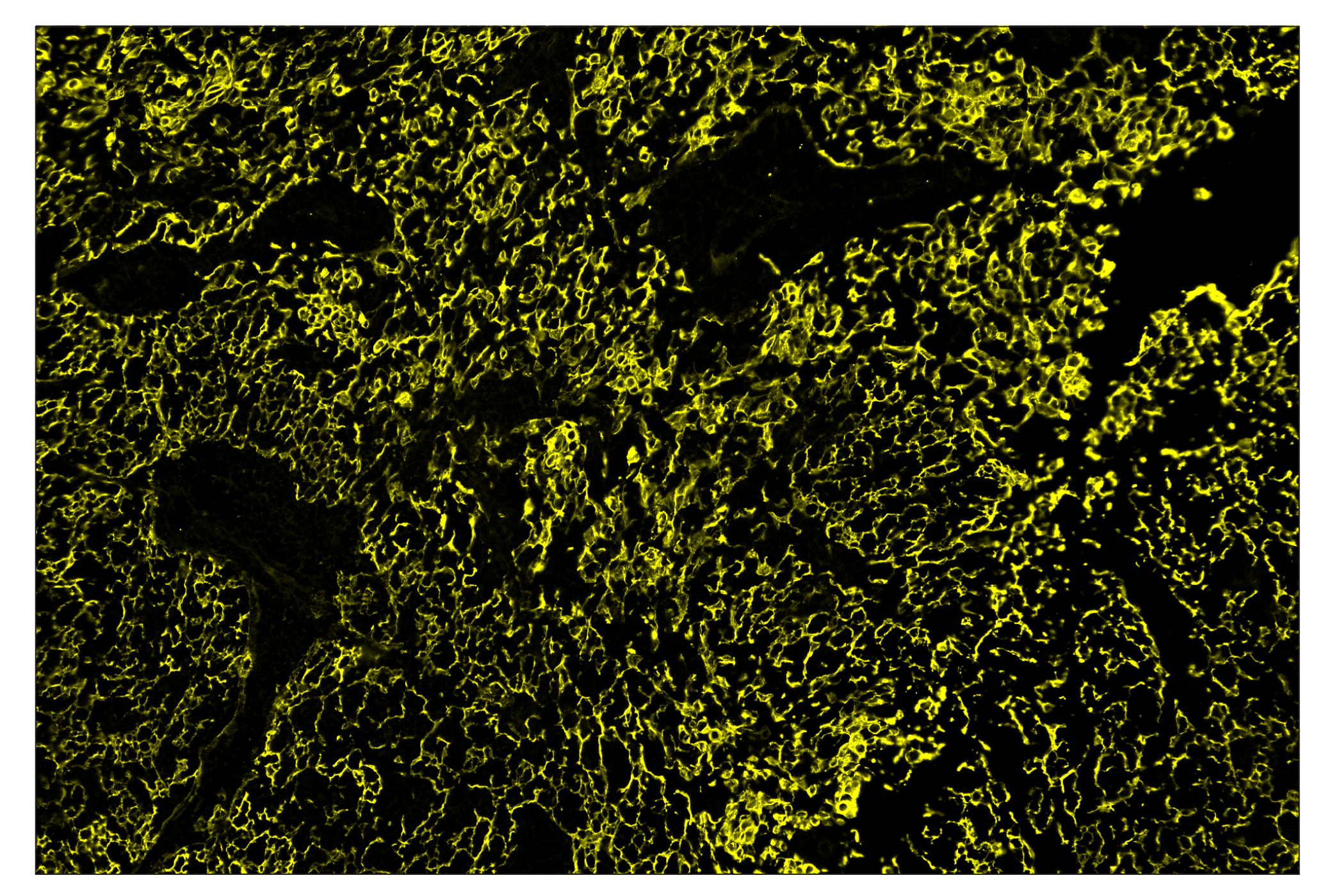 Immunohistochemistry Image 3: Pan-Keratin (Type I) (E6S1S) & CO-0072-594 SignalStar™ Oligo-Antibody Pair