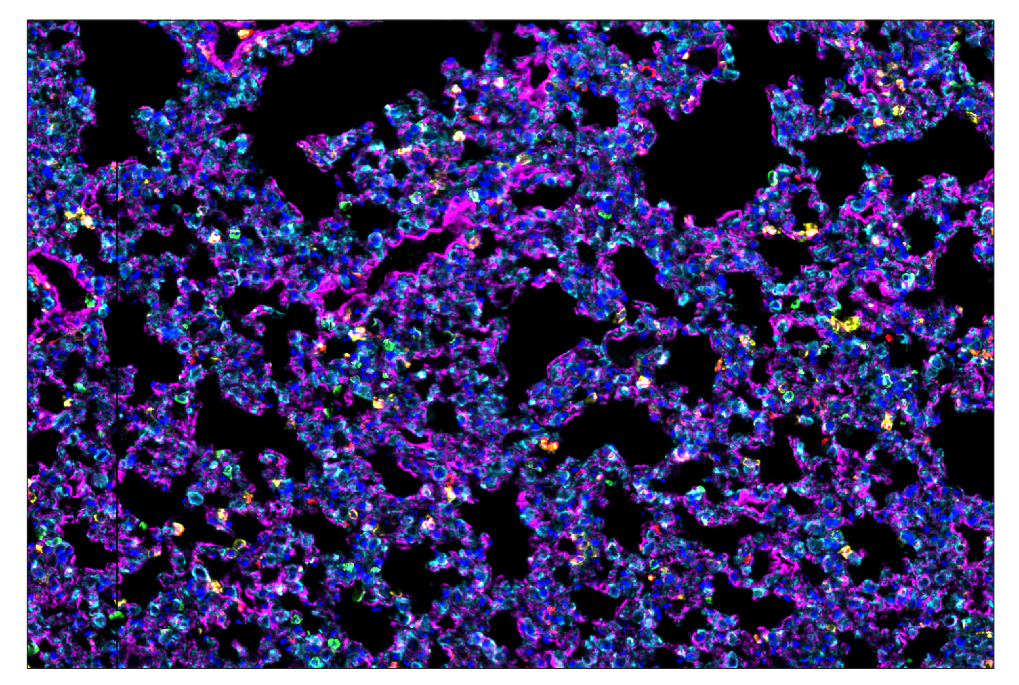 Immunohistochemistry Image 1: Pan-Keratin (Type I) (E6S1S) & CO-0072-488 SignalStar™ Oligo-Antibody Pair