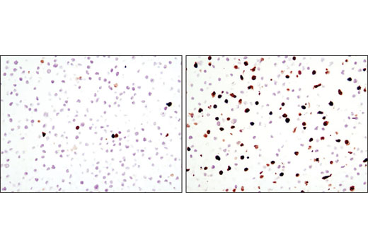 Immunohistochemistry Image 1: Cleaved Caspase-3 (Asp175) (D3E9) Rabbit mAb (BSA and Azide Free)
