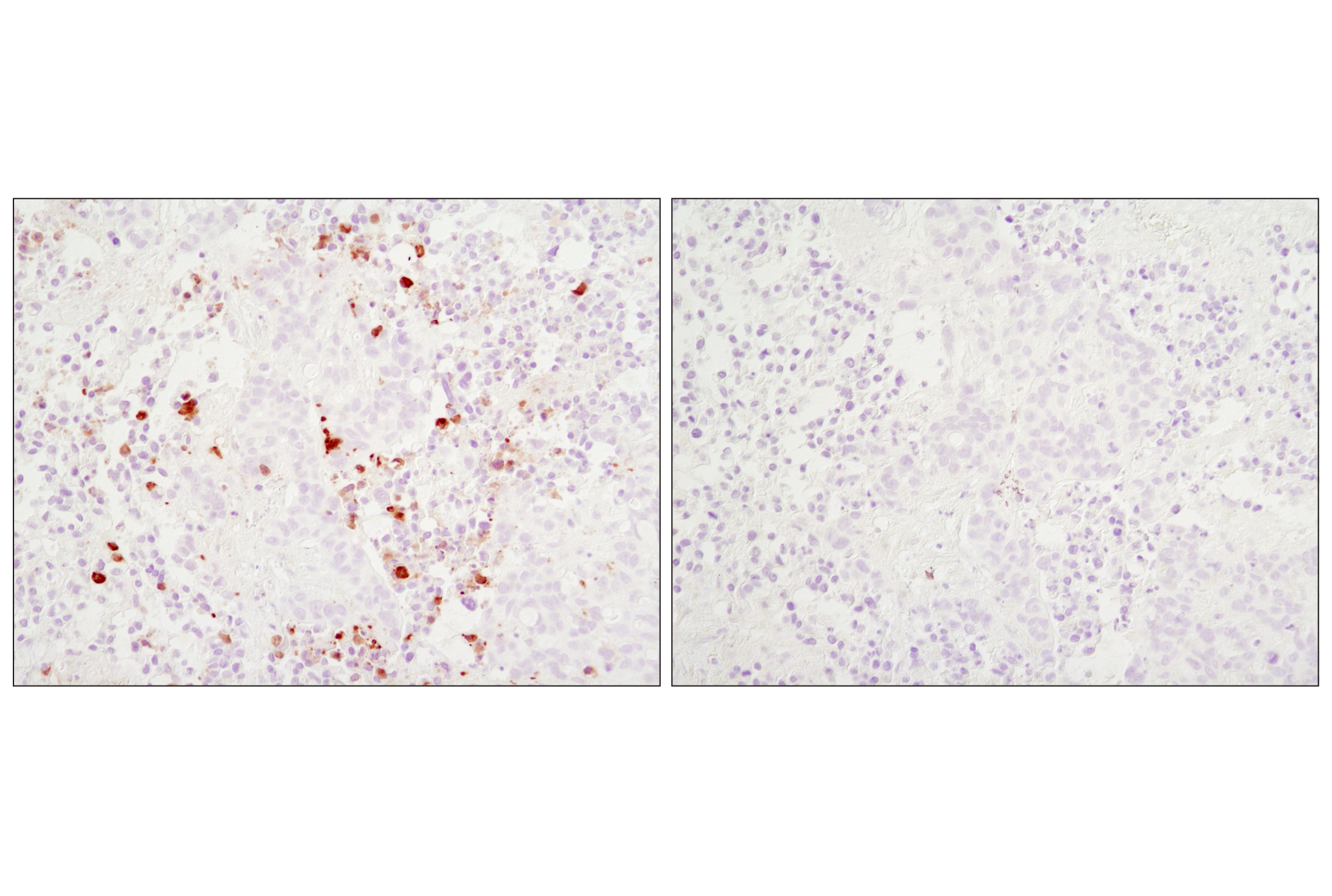 Immunohistochemistry Image 3: Cleaved Caspase-3 (Asp175) (D3E9) Rabbit mAb (BSA and Azide Free)