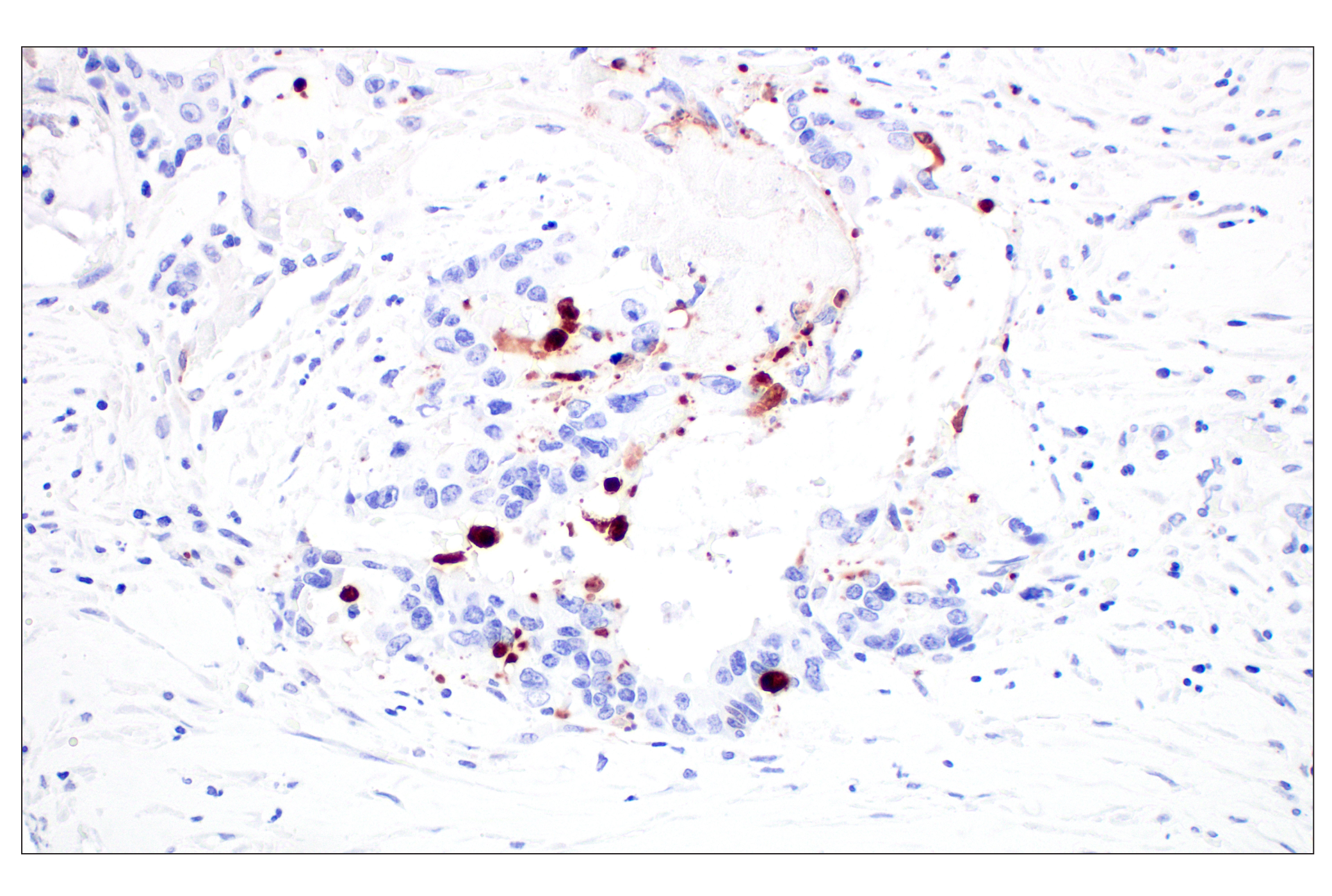 Immunohistochemistry Image 5: Cleaved Caspase-3 (Asp175) (D3E9) Rabbit mAb (BSA and Azide Free)