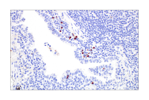 Immunohistochemistry Image 4: Cleaved Caspase-3 (Asp175) (D3E9) Rabbit mAb (BSA and Azide Free)