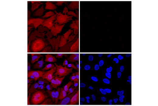 Immunofluorescence Image 1: Cofilin (D3F9) XP® Rabbit mAb (Alexa Fluor® 555 Conjugate)