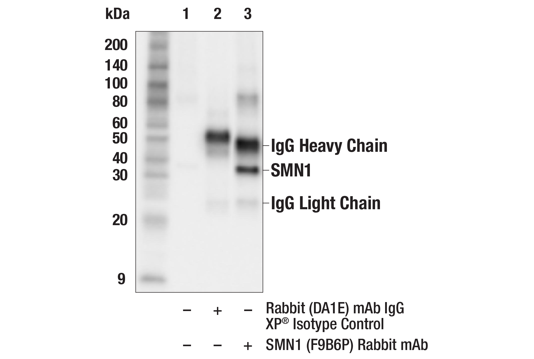 Immunoprecipitation Image 1: SMN1 (F9B6P) Rabbit mAb