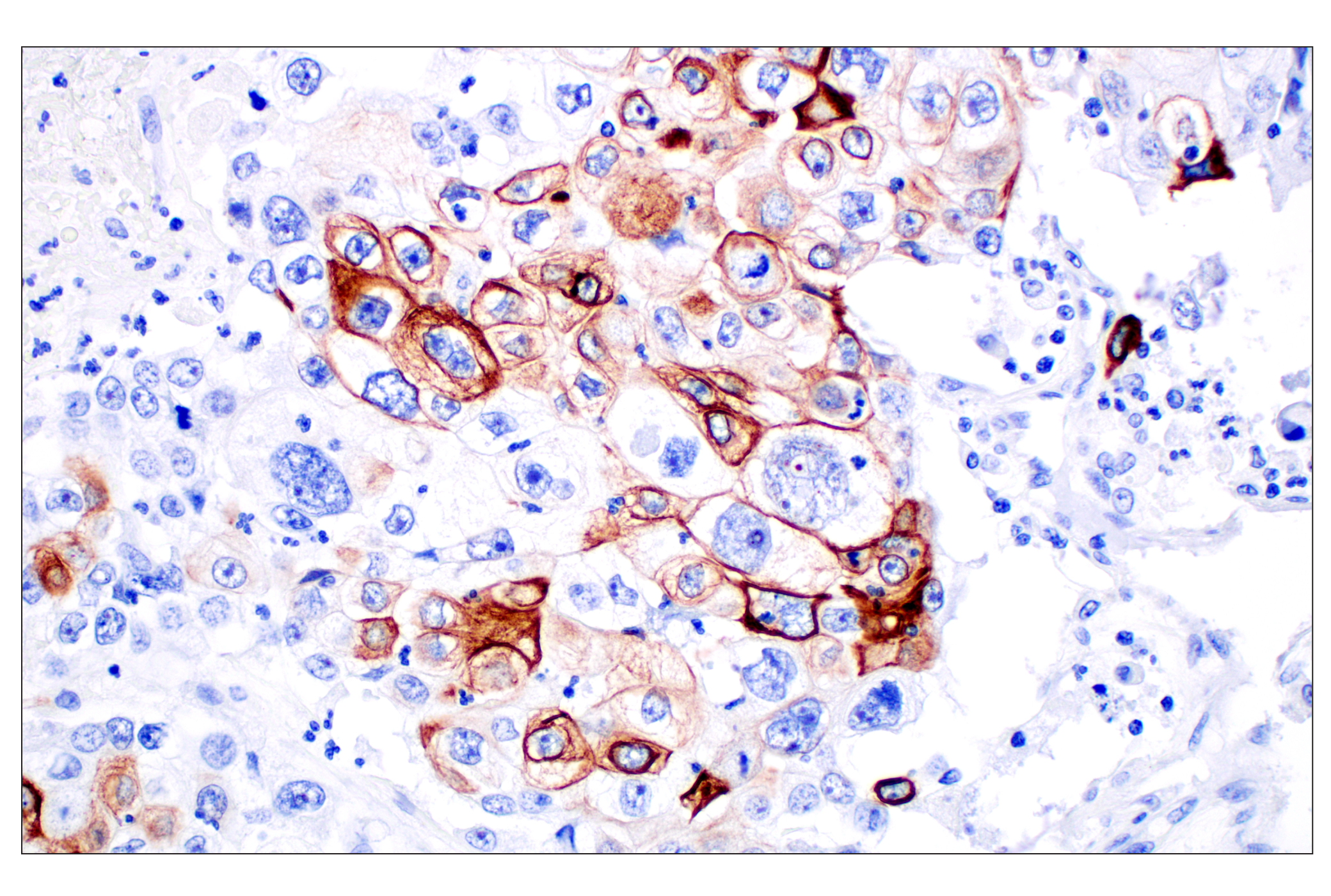 Immunohistochemistry Image 3: Keratin 14 (E7W6V) Rabbit mAb