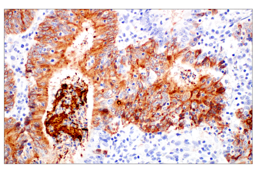 Immunohistochemistry Image 1: MUC5B (E4Y5Z) Rabbit mAb
