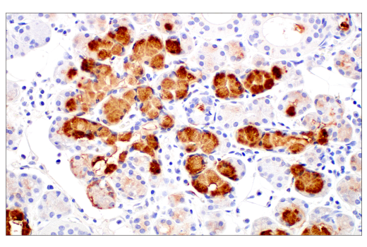 Immunohistochemistry Image 7: MUC5B (E4Y5Z) Rabbit mAb