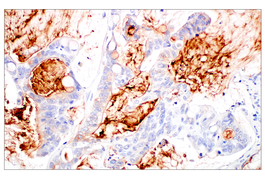 Immunohistochemistry Image 4: MUC5B (E4Y5Z) Rabbit mAb