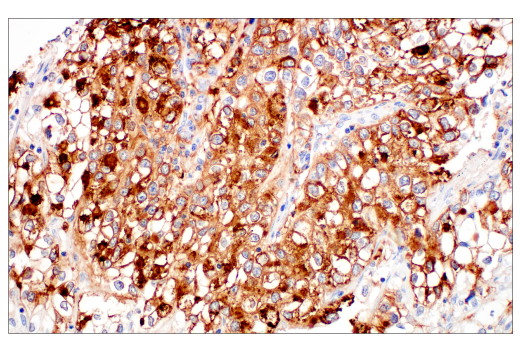 Immunohistochemistry Image 3: MUC5B (E4Y5Z) Rabbit mAb