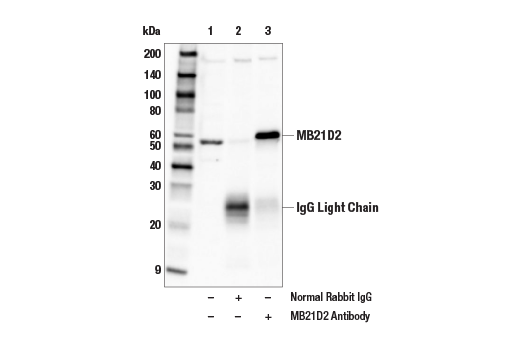 Immunoprecipitation Image 1: MB21D2 Antibody