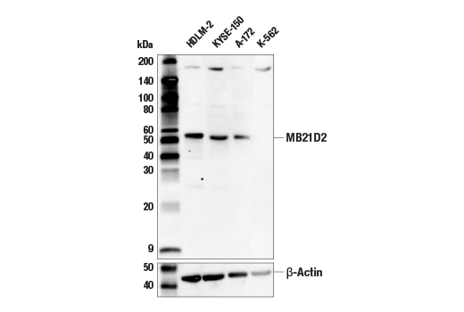 Western Blotting Image 1: MB21D2 Antibody