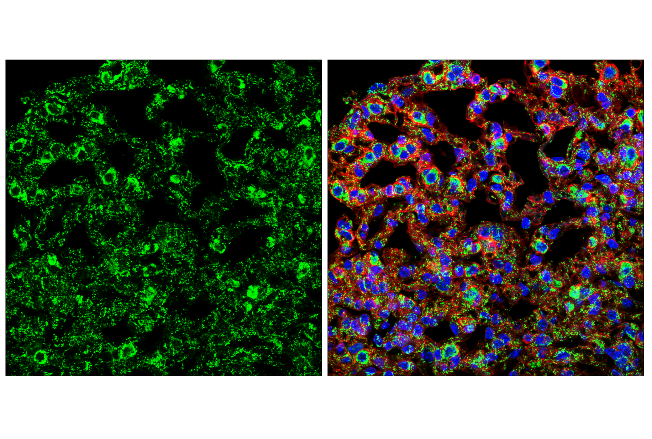 Immunofluorescence Image 2: Mm47 (F4E5V) Rabbit mAb
