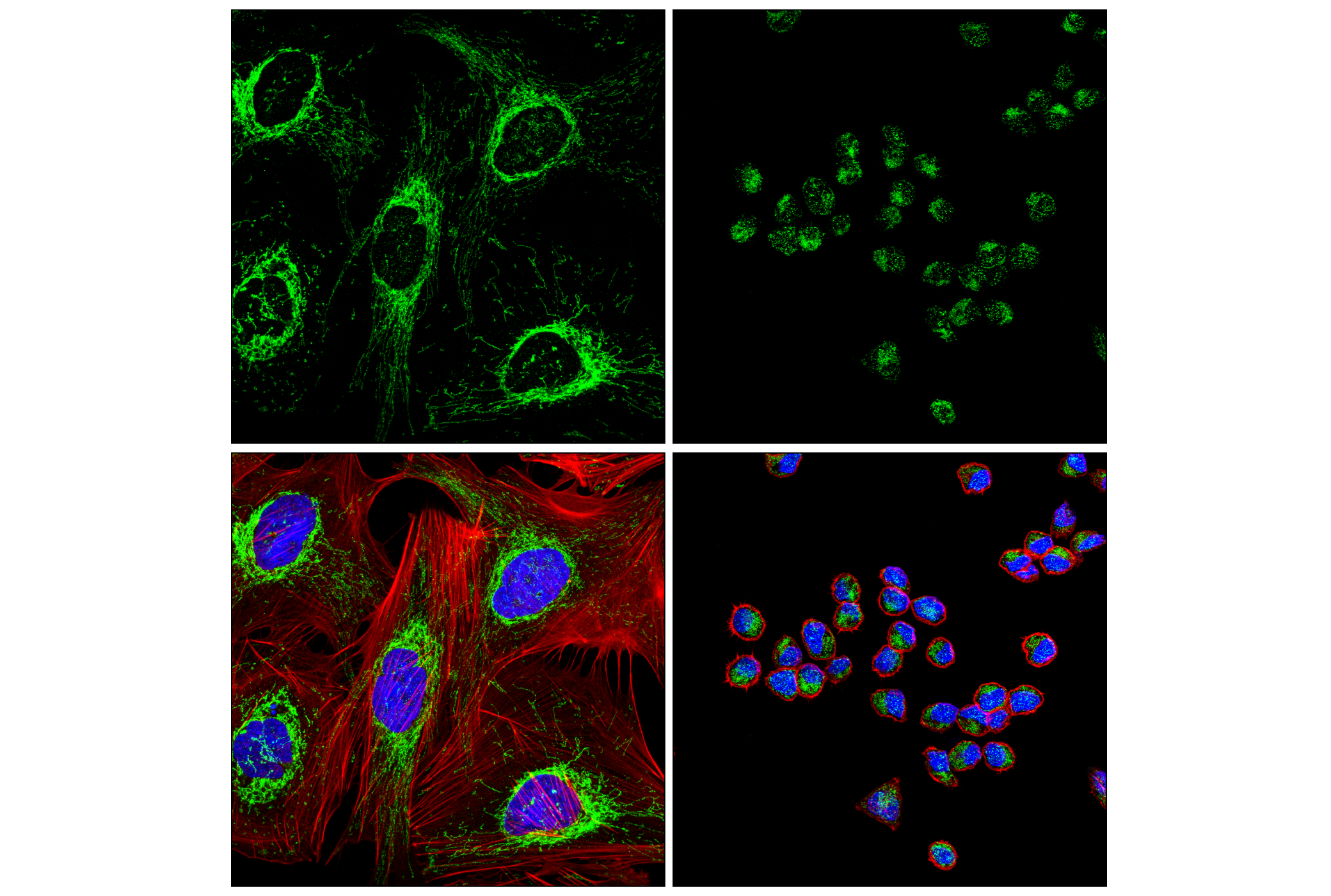 Immunofluorescence Image 5: Mm47 (F4E5V) Rabbit mAb