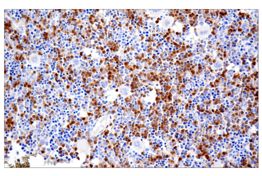 Immunohistochemistry Image 2: Ly-6G (E6Z1T) Rabbit mAb (BSA and Azide Free)