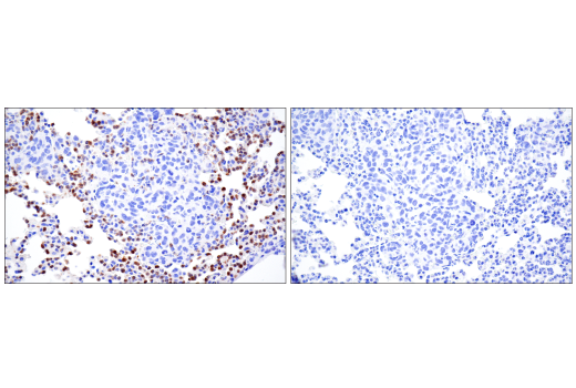 Immunohistochemistry Image 5: Ly-6G (E6Z1T) Rabbit mAb (BSA and Azide Free)