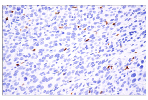 Immunohistochemistry Image 4: Ly-6G (E6Z1T) Rabbit mAb (BSA and Azide Free)