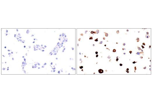 Immunohistochemistry Image 6: Ly-6G (E6Z1T) Rabbit mAb (BSA and Azide Free)