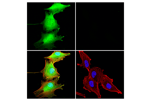 Immunofluorescence Image 2: MIF (E8S8H) Rabbit mAb