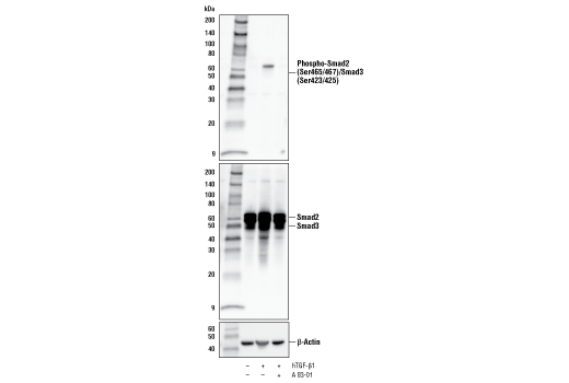 Human HNRNPH1 / hnRNP H Protein Recombinant His-SUMO aa 2-449