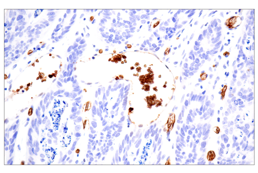 Immunohistochemistry Image 7: CD235a/Glycophorin A (JC159) Rabbit mAb